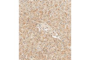 Immunohistochemical analysis of paraffin-embedded Human liver tissue using (ABIN390596 and ABIN2840914) performed on the Leica® BOND RXm.