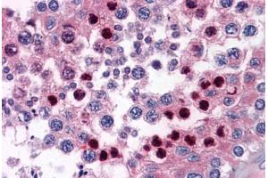 Human Testis: Formalin-Fixed, Paraffin-Embedded (FFPE)