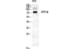 Western Blot (WB) analysis of NIH-3T3 cells using CPTI-M Polyclonal Antibody. (CPT1B anticorps  (Internal Region))
