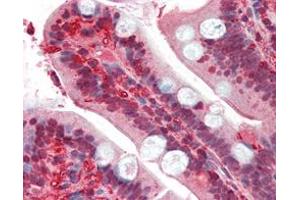 Immunohistochemical analysis of paraffin-embedded human small intestine tissues uing RSK1 mouse mAb.