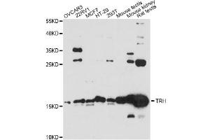 Western blot analysis of extracts of various cell lines, using KRBOX4 antibody (ABIN6289960) at 1:3000 dilution. (KRAB Box Domain Containing 4 (KRBOX4) anticorps)
