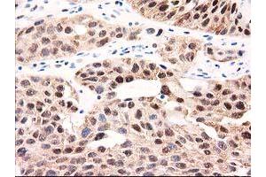 Image no. 8 for anti-UDP-Galactose-4-Epimerase (GALE) antibody (ABIN1498366) (GALE anticorps)