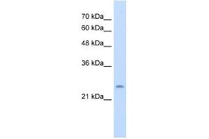 CHIC1 antibody used at 5 ug/ml to detect target protein. (CHIC1 anticorps  (N-Term))