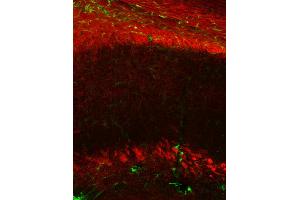 Immunohistochemistry (IHC) image for anti-Claudin 11 (CLDN11) (AA 188-207) antibody (ABIN1742489)