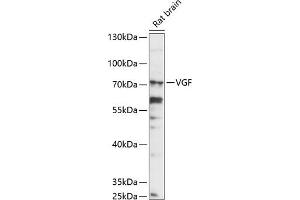 Western blot analysis of extracts of rat brain, using VGF antibody (ABIN7271321) at 1:1000 dilution. (VGF anticorps  (AA 466-615))