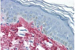 Human Skin (formalin-fixed, paraffin-embedded) stained with Collagen I antibody ABIN291823 at 2. (Collagen Type I anticorps)