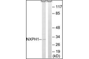 Western blot analysis of extracts from rat heart cells, using NXPH1 Antibody . (Neurexophilin 1 anticorps  (C-Term))