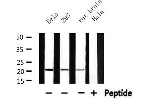 Western blot analysis of extracts from 293 and hela and rat brain, using MRPL11 Antibody. (MRPL11 anticorps  (Internal Region))