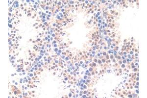 Detection of APOD in Mouse Testis Tissue using Polyclonal Antibody to Apolipoprotein D (APOD)