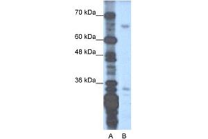 WB Suggested Anti-ZNF691 Antibody Titration:  1. (ZNF691 anticorps  (N-Term))