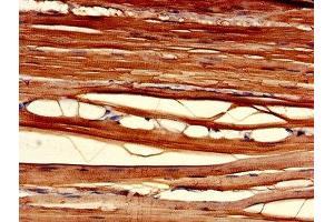Immunohistochemistry of paraffin-embedded human skeletal muscle tissue using ABIN7147586 at dilution of 1:100 (CLIC2 anticorps  (AA 53-247))