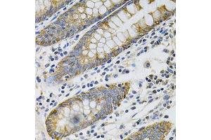 Immunohistochemistry of paraffin-embedded human colon using KRT20 Antibody. (KRT20 anticorps  (AA 245-424))