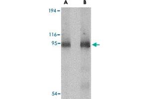 Western blot analysis of CD180 in human spleen tissue lysate with CD180 polyclonal antibody  at (A) 0. (CD180 anticorps  (C-Term))