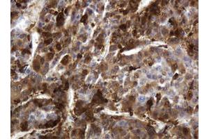 Image no. 3 for anti-Thymidine Phosphorylase (TYMP) (AA 311-482) antibody (ABIN1491396)