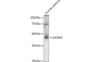 Western blot analysis of extracts of Human plasma, using C antibody (ABIN3022654, ABIN3022655, ABIN3022656 and ABIN6219028) at 1:1000 dilution. (CADM1 anticorps  (AA 45-344))