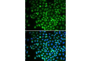 Immunofluorescence analysis of U2OS cell using POLR2D antibody. (POLR2D anticorps)