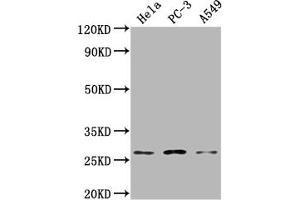 Western Blot Positive WB detected in: Hela whole cell lysate, PC-3 whole cell lysate, A549 whole cell lysate All lanes: RAB23 antibody at 1:2000 Secondary Goat polyclonal to rabbit IgG at 1/50000 dilution Predicted band size: 27 kDa Observed band size: 27 kDa (RAB23 anticorps  (AA 18-234))