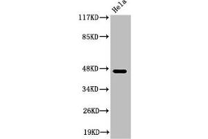 Western Blot analysis of HeLa cells using Cleaved-Plasma Kallikrein HC (R390) Polyclonal Antibody