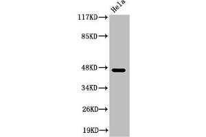 Western Blot analysis of HeLa cells using Cleaved-Plasma Kallikrein HC (R390) Polyclonal Antibody (KLKB1 anticorps  (Cleaved-Arg390))