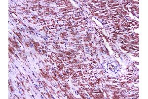 Formalin-fixed and paraffin embedded mouse heart tissue labeled Anti-Connexin-45 Polyclonal Antibody, Unconjugated (ABIN671466) at 1:200, followed by conjugation to the secondary antibody and DAB staining (GJC1 anticorps  (AA 81-130))