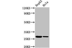Western Blot Positive WB detected in: HepG2 whole cell lysate, Hela whole cell lysate All lanes: VPS29 antibody at 3. (VPS29 anticorps  (AA 68-145))