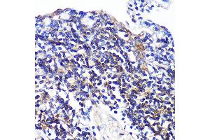 Immunohistochemistry of paraffin-embedded Human lung using SW Rabbit pAb (ABIN7270654) at dilution of 1:100 (40x lens).