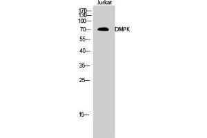 Western Blot (WB) analysis of Jurkat cells using DMPK Polyclonal Antibody. (DMPK anticorps  (N-Term))