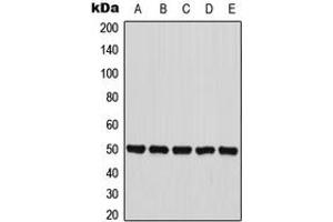Western blot analysis of PANK2 expression in HepG2 (A), MCF7 (B), HT29 (C), mouse liver (D), PC12 (E) whole cell lysates. (PANK2 anticorps  (Center))