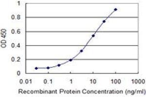 Detection limit for recombinant GST tagged ULK2 is 0.