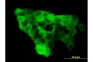 Immunofluorescence of monoclonal antibody to WWP1 on A-431 cell. (WWP1 anticorps  (AA 152-260))