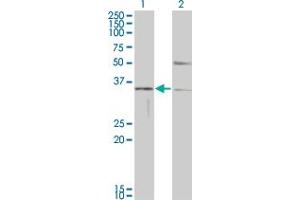 Western Blot analysis of HAVCR1 expression in transfected 293T cell line by HAVCR1 monoclonal antibody (M01), clone 1E5. (HAVCR1 anticorps  (AA 23-122))