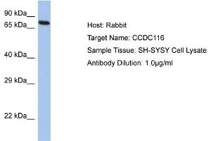 Host: Rabbit Target Name: CCDC116 Sample Tissue: Human SH-SYSY Whole Cell  Antibody Dilution: 1ug/ml