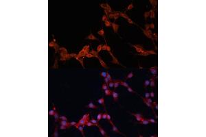 Immunofluorescence analysis of NIH/3T3 cells using SLC25 antibody (ABIN6128769, ABIN6147928, ABIN6147929 and ABIN6217136) at dilution of 1:100.
