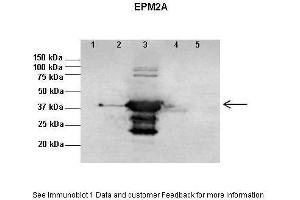 Western Blotting (WB) image for anti-Epilepsy, Progressive Myoclonus Type 2A, Lafora Disease (Laforin) (EPM2A) (N-Term) antibody (ABIN970635) (EPM2A anticorps  (N-Term))