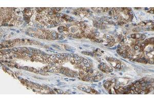 ABIN6279709 at 1/100 staining Human prostate tissue by IHC-P. (RABL5 anticorps  (Internal Region))