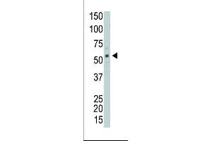 anti-Protein Interacting With Protein Kinase C, alpha 1 (PICK1) (AA 1-30), (N-Term) antibody