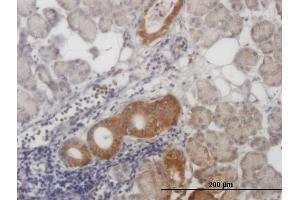 Immunoperoxidase of monoclonal antibody to ALS2CR8 on formalin-fixed paraffin-embedded human salivary gland.
