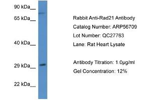 Western Blotting (WB) image for anti-RAD21 Homolog (RAD21) (N-Term) antibody (ABIN2786857) (RAD21 anticorps  (N-Term))