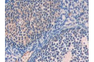 DAB staining on IHC-P; Samples: Mouse Ovary Tissue (Fetuin A anticorps  (AA 19-250))