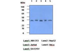 Image no. 1 for anti-C-Reactive Protein (CRP) (AA 19-224) antibody (ABIN6245663) (CRP anticorps  (AA 19-224))