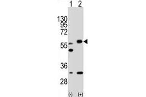 Western blot analysis of LKB1 antibody and 293 cell lysate (2 ug/lane) either nontransfected (Lane 1) or transiently transfected with the STK11 gene (2).