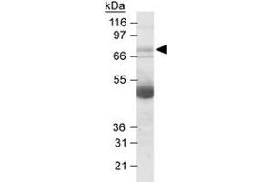 Western blot analysis of NOX4 in human kidney lysates with NOX4 polyclonal antibody at 2. (NADPH Oxidase 4 anticorps  (AA 100-200))