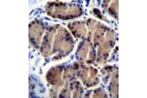 Immunohistochemistry analysis in formalin fixed and paraffin embedded human stomach tissue reacted with LIPC / Hepatic lipase (Center) followed by peroxidase conjugation of the secondary antibody and DAB staining.