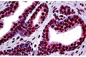 Human Prostate: Formalin-Fixed, Paraffin-Embedded (FFPE) (MEF2A anticorps  (AA 71-170))