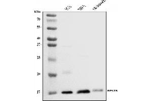 Western blot analysis of RPL23 using anti-RPL23 antibody (ABIN7599808).