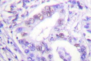 Image no. 1 for anti-Protein Inhibitor of Activated STAT, 4 (PIAS4) antibody (ABIN271954) (PIAS4 anticorps)