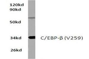 Image no. 1 for anti-CCAAT/enhancer Binding Protein (C/EBP), beta (CEBPB) antibody (ABIN272175) (CEBPB anticorps)