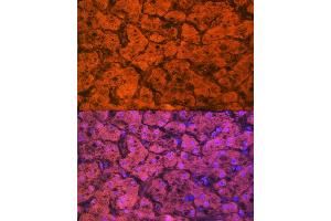 Immunofluorescence analysis of human liver using Hemopexin (HPX) (HPX) Rabbit mAb (ABIN7267611) at dilution of 1:100 (40x lens).