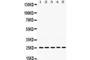 Western Blotting (WB) image for anti-Progesterone Receptor Membrane Component 1 (PGRMC1) (AA 67-102), (Middle Region) antibody (ABIN3043899) (PGRMC1 anticorps  (Middle Region))