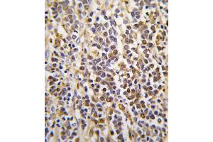 Immunohistochemistry (IHC) image for anti-Aldehyde Dehydrogenase 1 Family, Member A3 (ALDH1A3) antibody (ABIN3003524) (ALDH1A3 anticorps)
